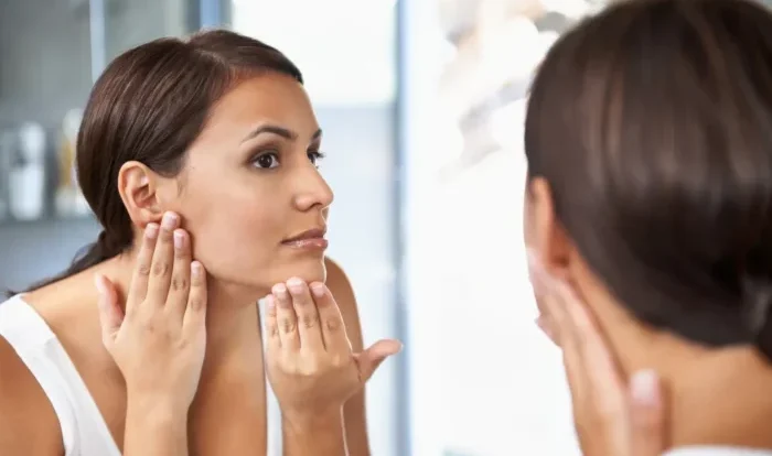 أعراض تكيس المبايض على البشرة