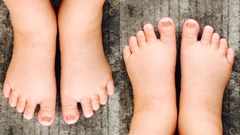 Swollen Feet During Pregnancy Mama Natural Remedies tips1