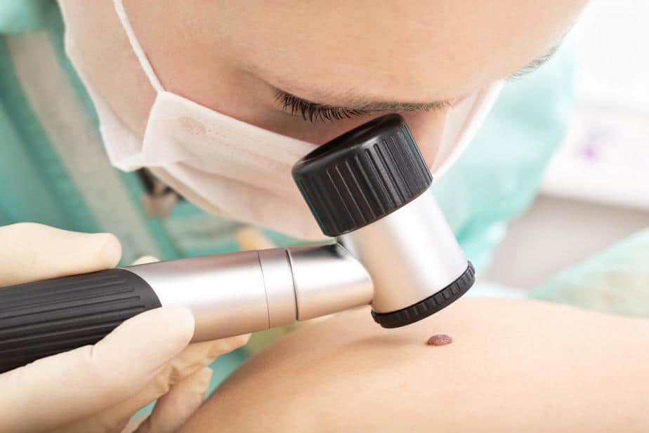 dermatologist inspecting mole