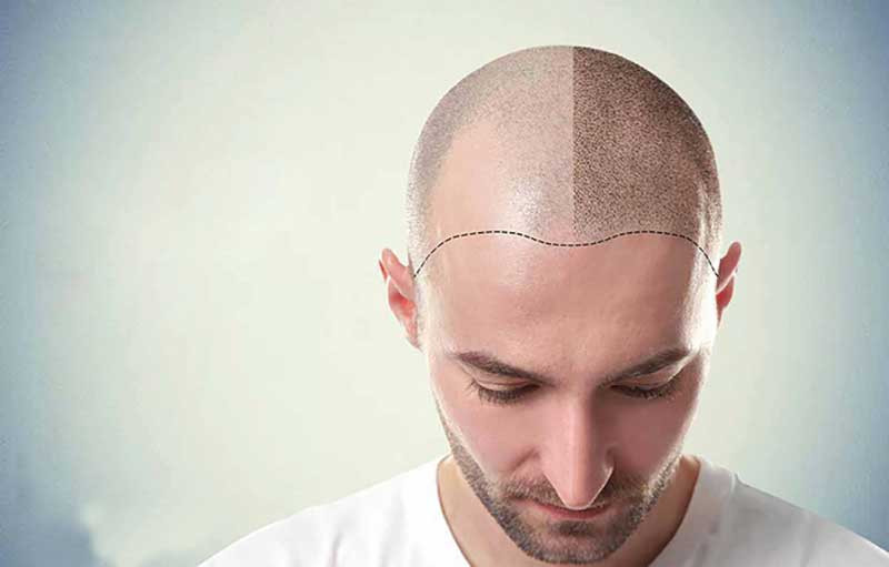 hair 11