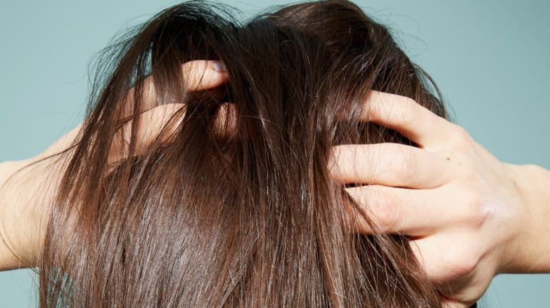 5 اسباب تهيج فروة الراس عند النساء - أونيلا