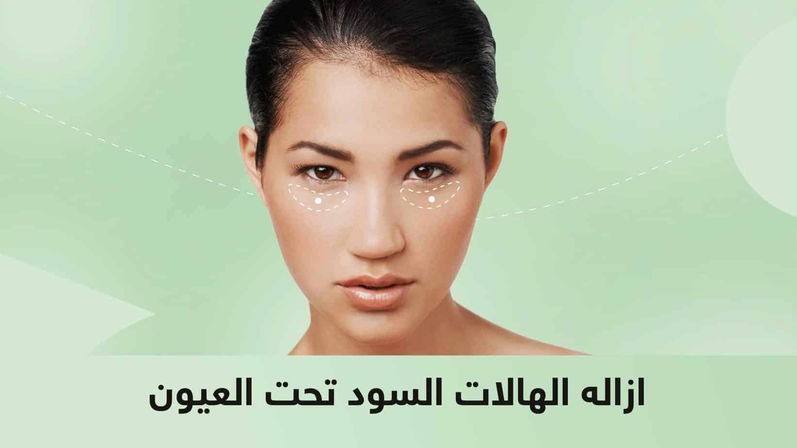 الهالات السود تحت العيون scaled